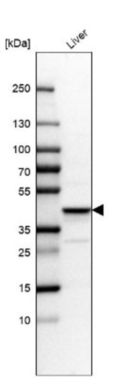 MRN Complex Interacting Protein Antibody, Novus Biologicals 0.1mL; Unlabeled:Antibodies,